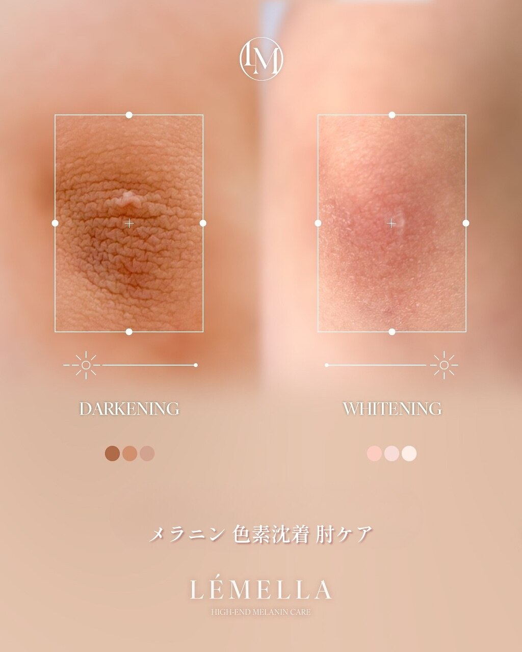 ウェルビー(Well-Be)の施術アイテム